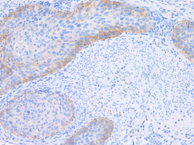 FGFR2b Mouse Monoclonal Antibody(ARM616)