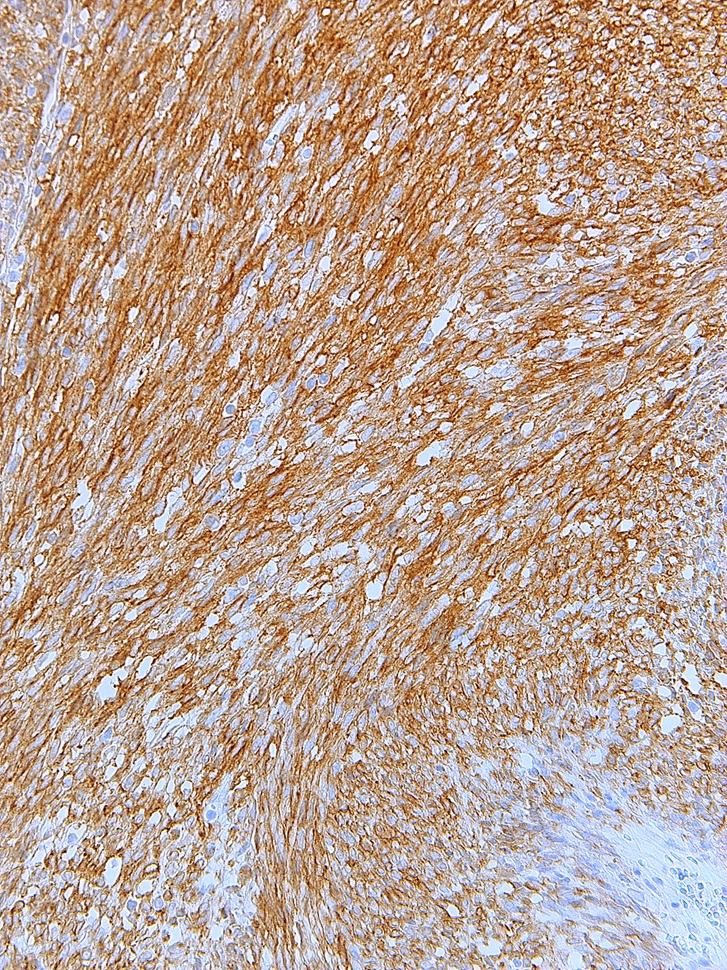 CD117 Rabbit Monoclonal Antibody(ARM602)