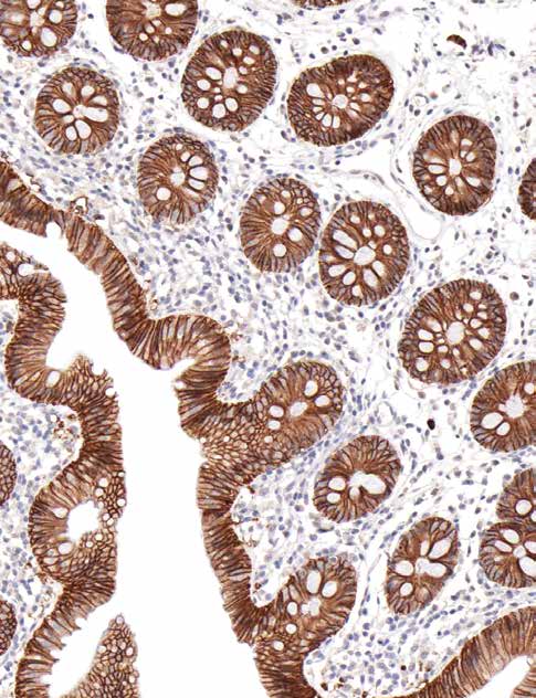 Ep-CAM/Ber-EP4 Mouse Monoclonal Antibody(ARM912)