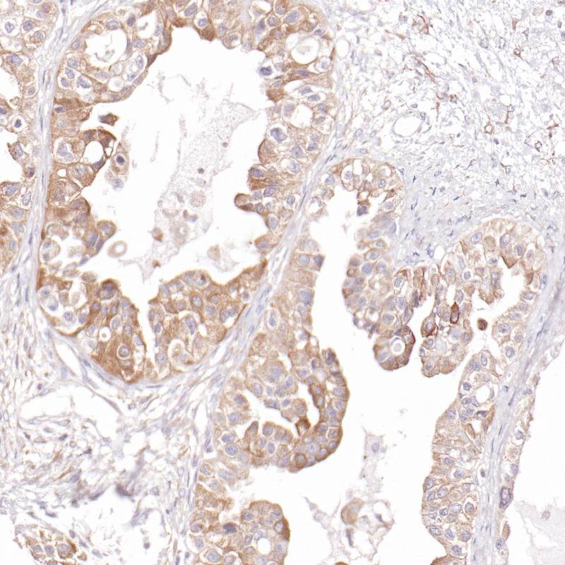 LRP  Monoclonal Antibody(ARB598)