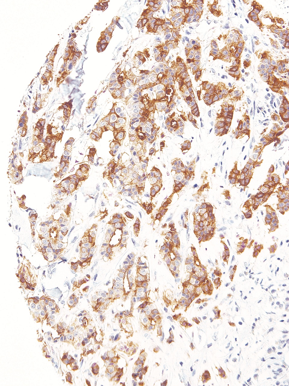B7H4 Mouse Monoclonal Antibody(ARM599)