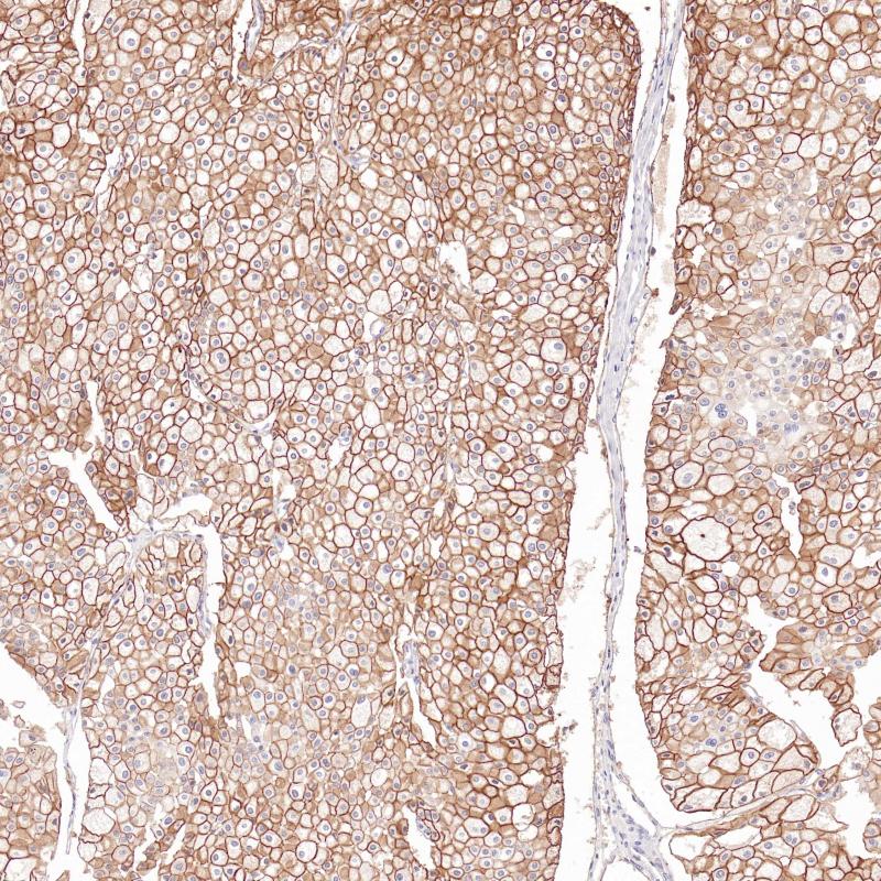 Cadherin 16 Monoclonal Antibody(ARB593)
