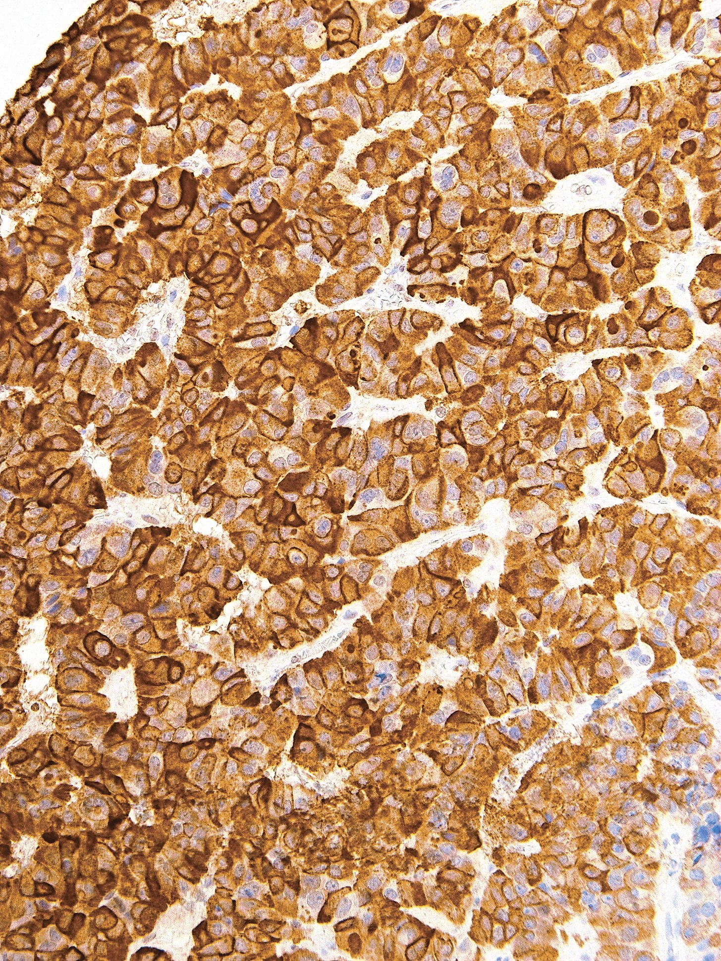 Luteinizing Hormone (LH) Mouse Monoclonal Antibody(ARM593)
