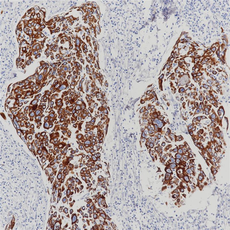 Cytokeratin (HMW) Rabbit Monoclonal Antibody Cocktail(ARB939/ARB933)