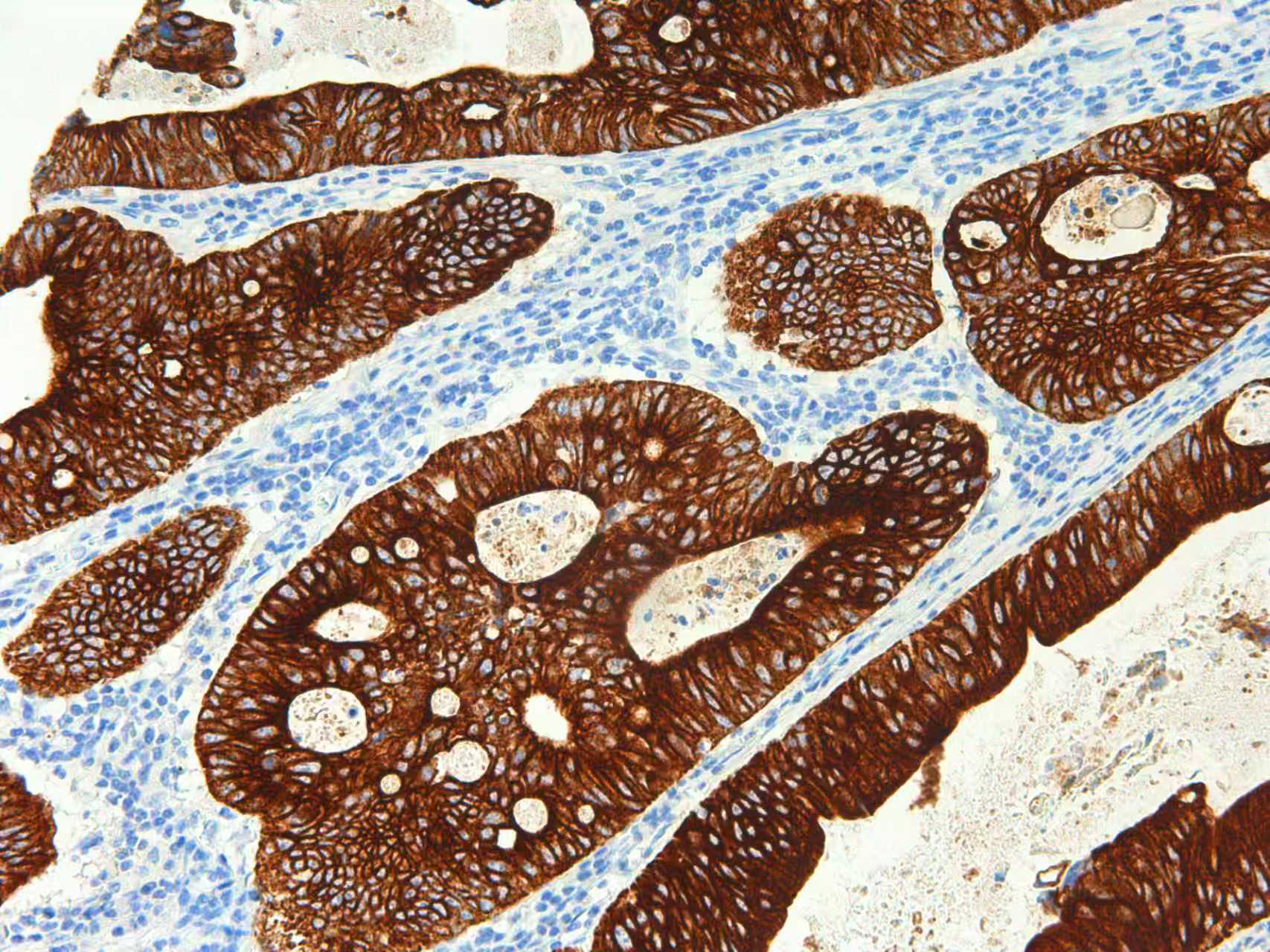 Cytokeratin CAM5.2 Mouse Monoclonal Antibody(ARM613)