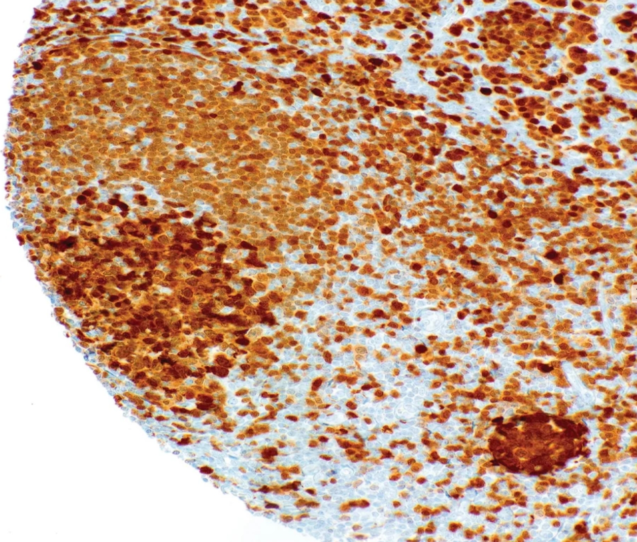 BOB-1 Rabbit Monoclonal Antibody(ARM600)
