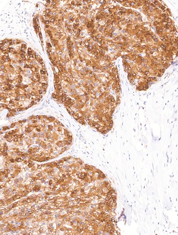 Glutamine Synthetase Mouse Monoclonal Antibody(ARM619)