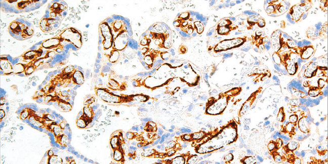 Flt-1/VEGFR1 Rabbit Monoclonal Antibody(ARM618)