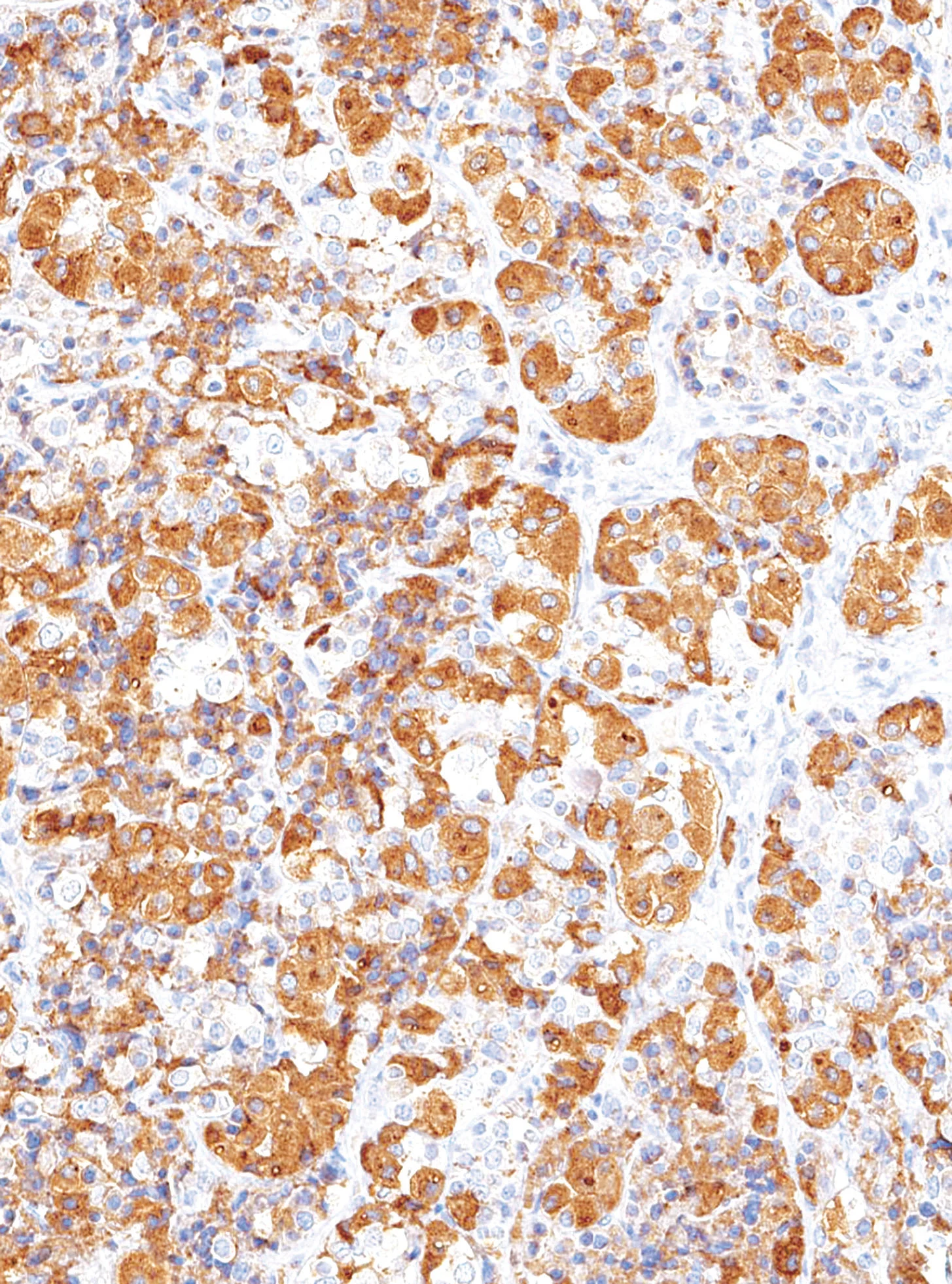 ACTH Mouse Monoclonal Antibody(ARM596)