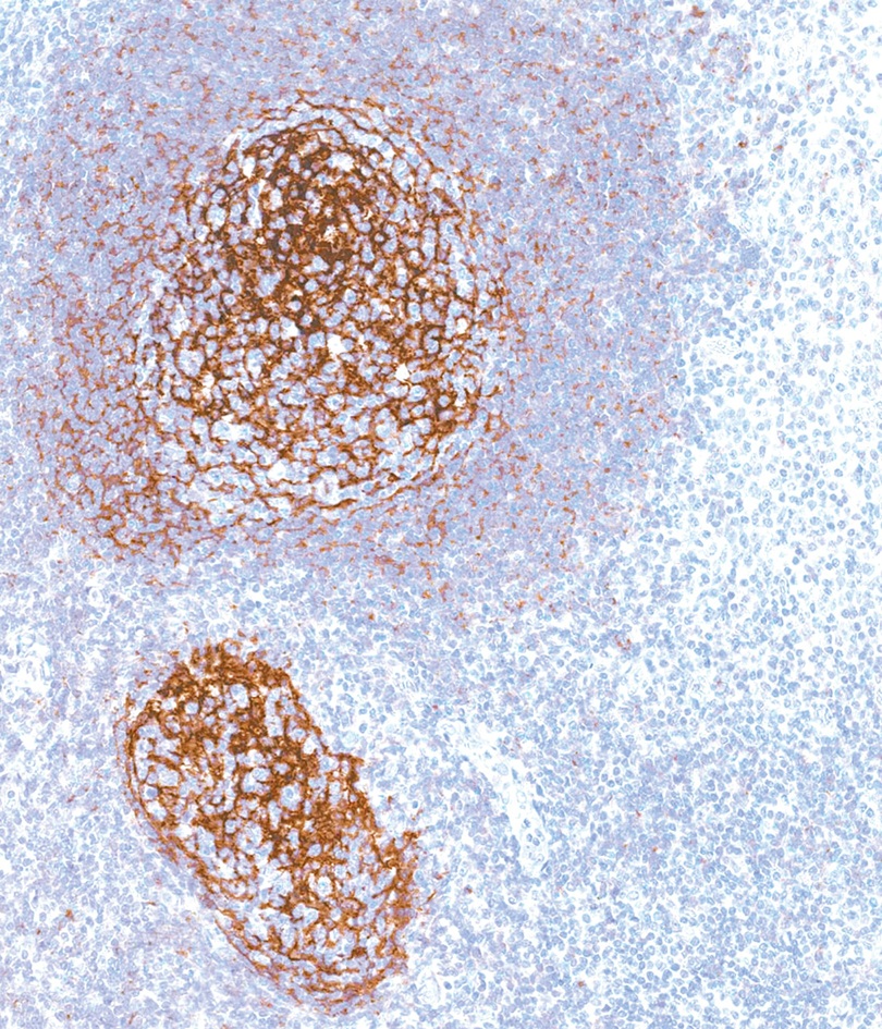 CD21 Mouse Monoclonal Antibody(ARM605)