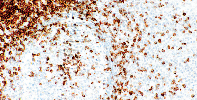 CD7 Rabbit Monoclonal Antibody(ARM608)