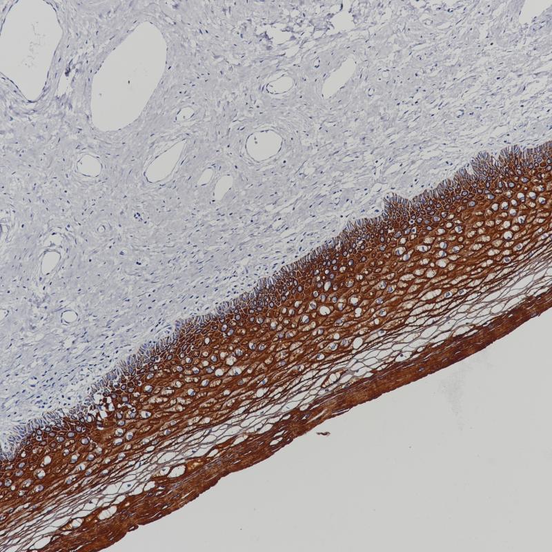 Cytokeratin 5&6 Rabbit Monoclonal Antibody Cocktail(ARB939/ARB940)