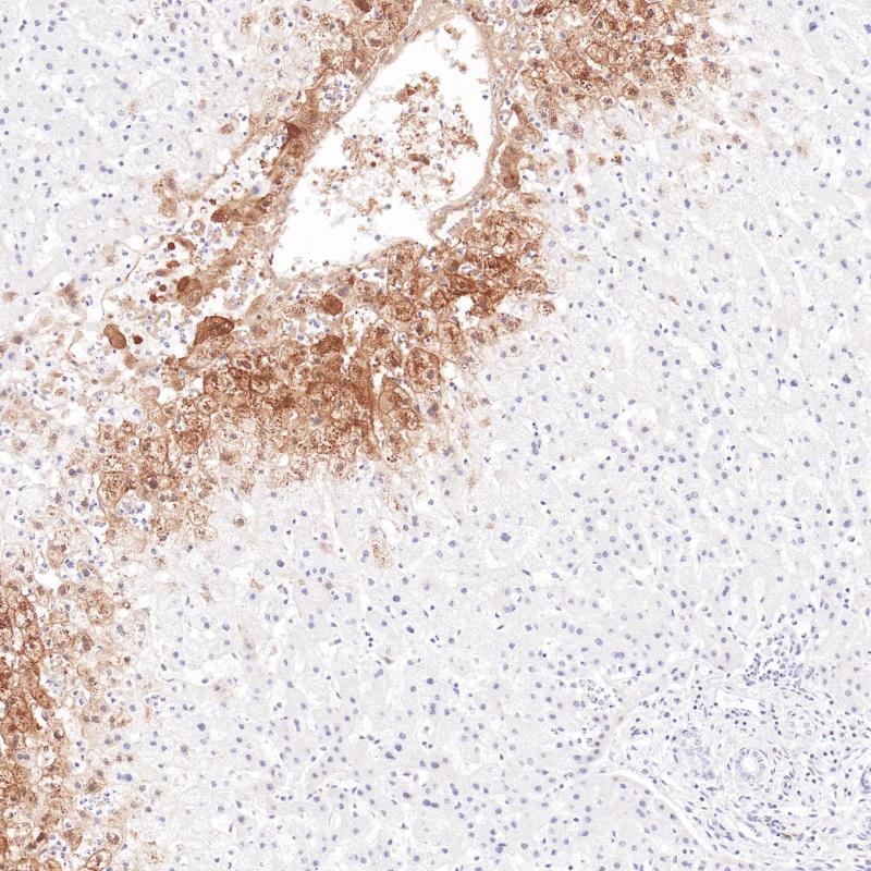 GS  Monoclonal Antibody(ARB596)