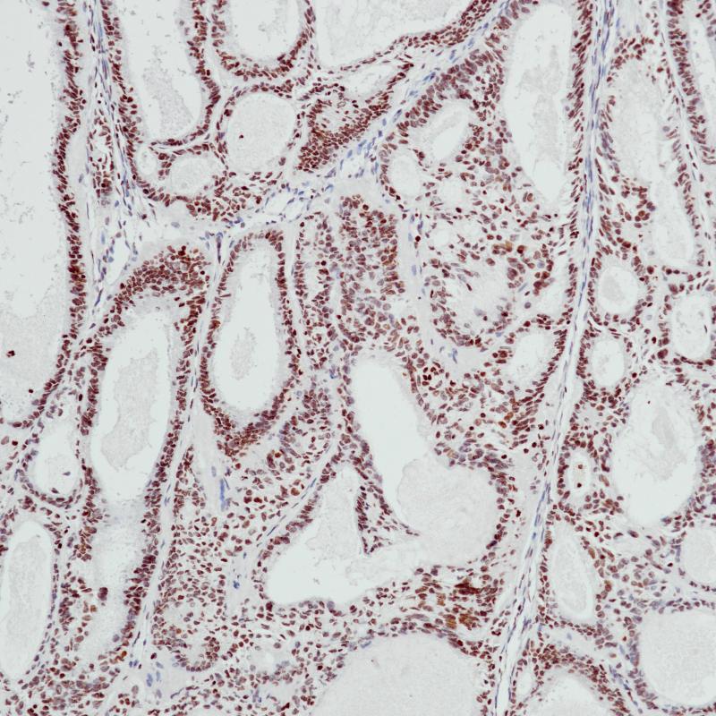 BCOR  Monoclonal Antibody(ARB595)