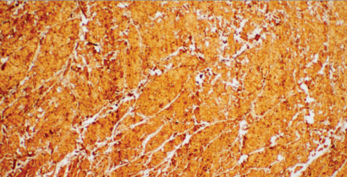 cTnI Mouse Monoclonal Antibody(ARM612)