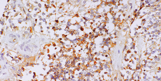 D-Dimer Mouse Monoclonal Antibody(ARM614)