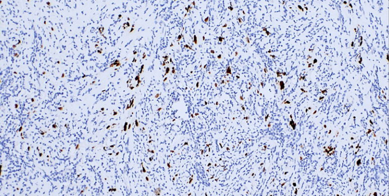 HMGA2 Rabbit Monoclonal Antibody(ARM624)