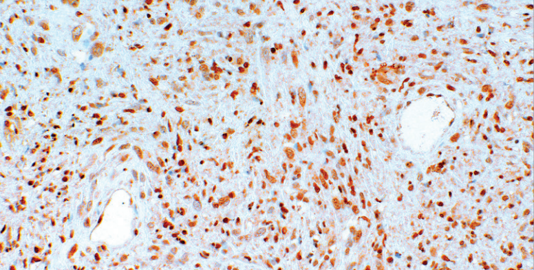 MGMT Mouse Monoclonal Antibody(ARM633)