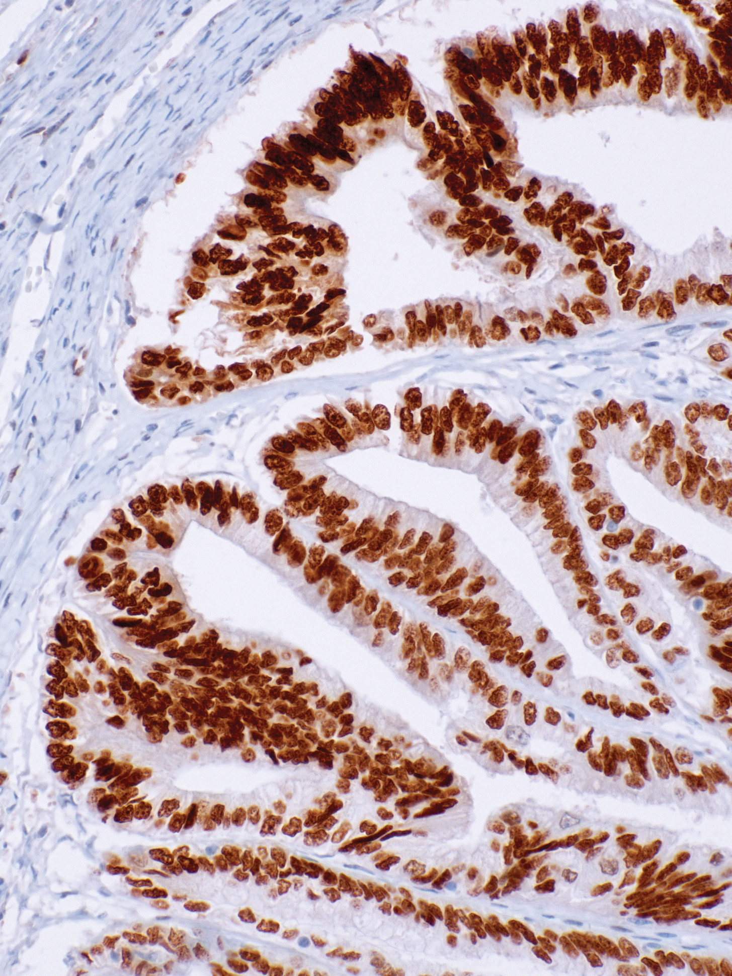 SOX-17 Rabbit Monoclonal Antibody(ARM646)