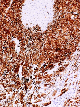 MART-1 (Melan A) Mouse Monoclonal Antibody(ARM631)