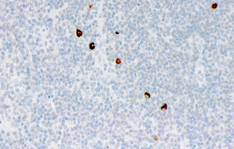 IgM Mouse Monoclonal Antibody(ARM627)