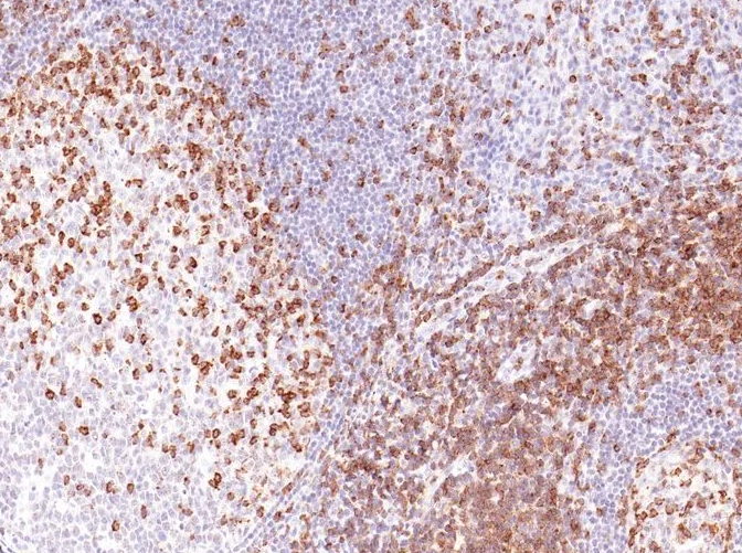 Cadherin-17 Rabbit Monoclonal Antibody(ARM933)