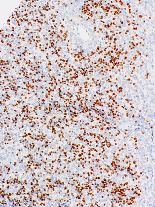 TdT Rabbit Monoclonal Antibody(ARM649)