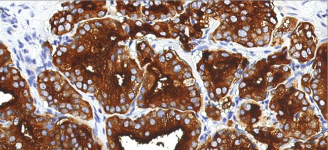 SATB2 Rabbit Monoclonal Antibody(ARM643)