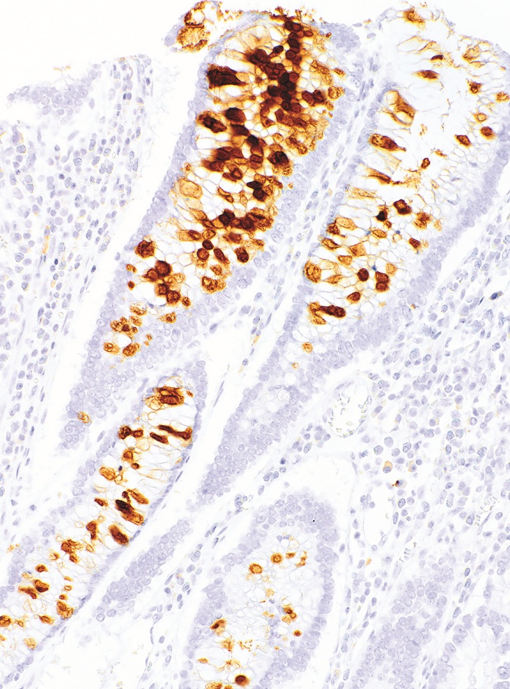 MUC6 Mouse Monoclonal Antibody(ARM635)