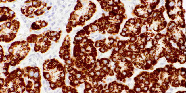 Hepatocyte Specific Antigen Mouse Monoclonal Antibody(ARM622)