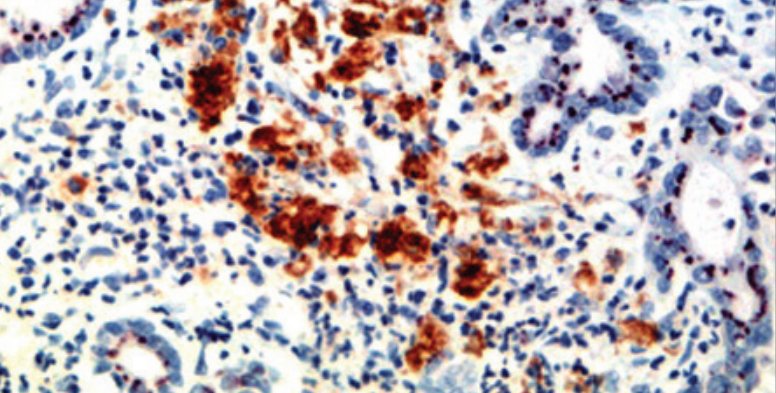 Sonic Hedgehog Rabbit Monoclonal Antibody(ARM645)