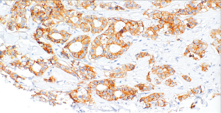 Her3 Mouse Monoclonal Antibody(ARM623)