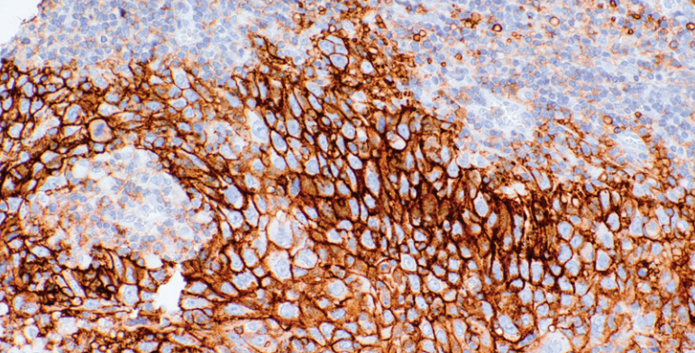 MCT4 Mouse Monoclonal Antibody(ARM632)