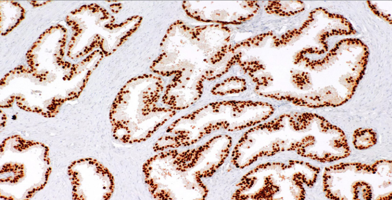 NKX3.1 Rabbit Monoclonal Antibody(ARM637)