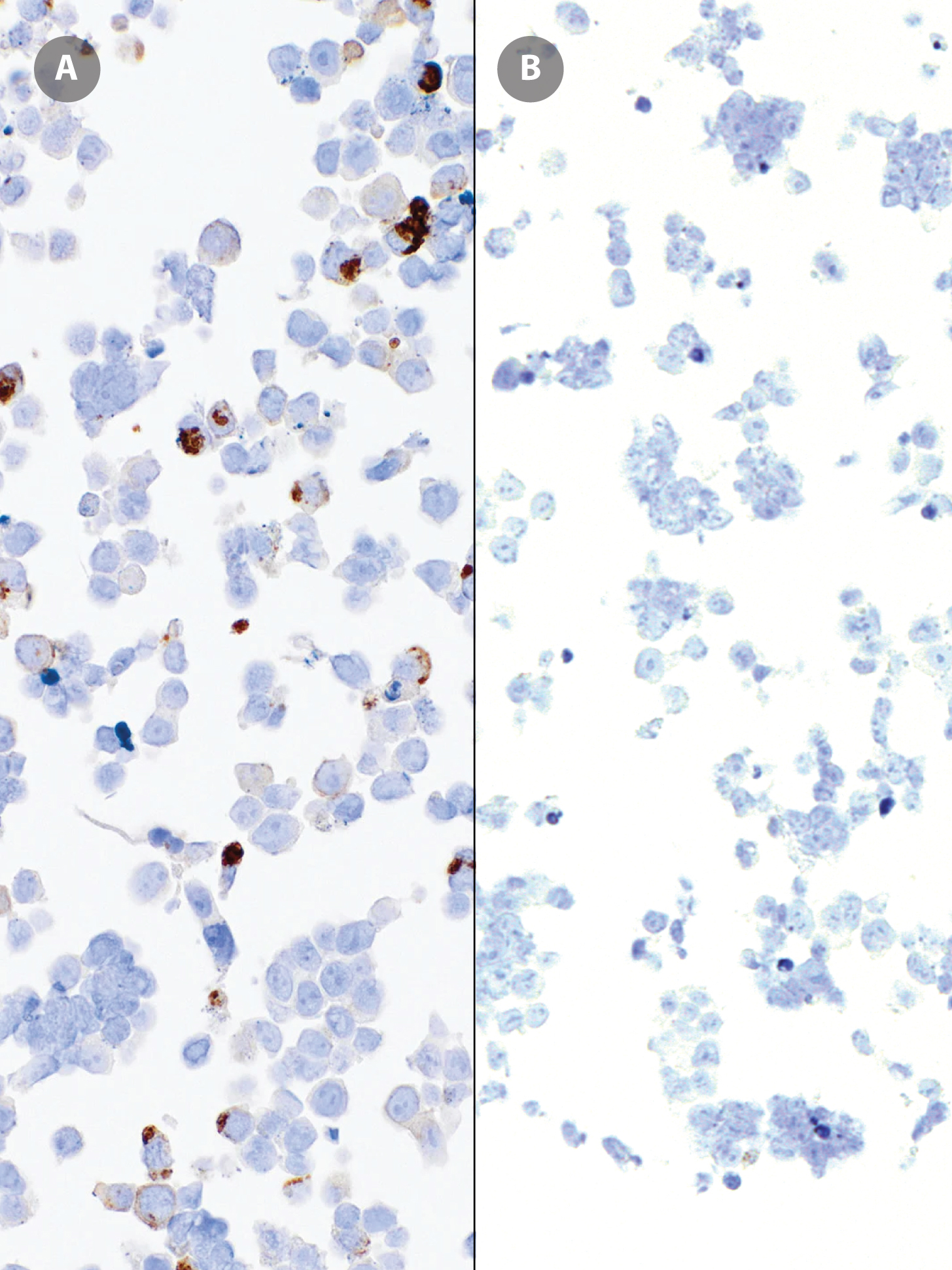 NTRK Rabbit Monoclonal Antibody(ARM639)