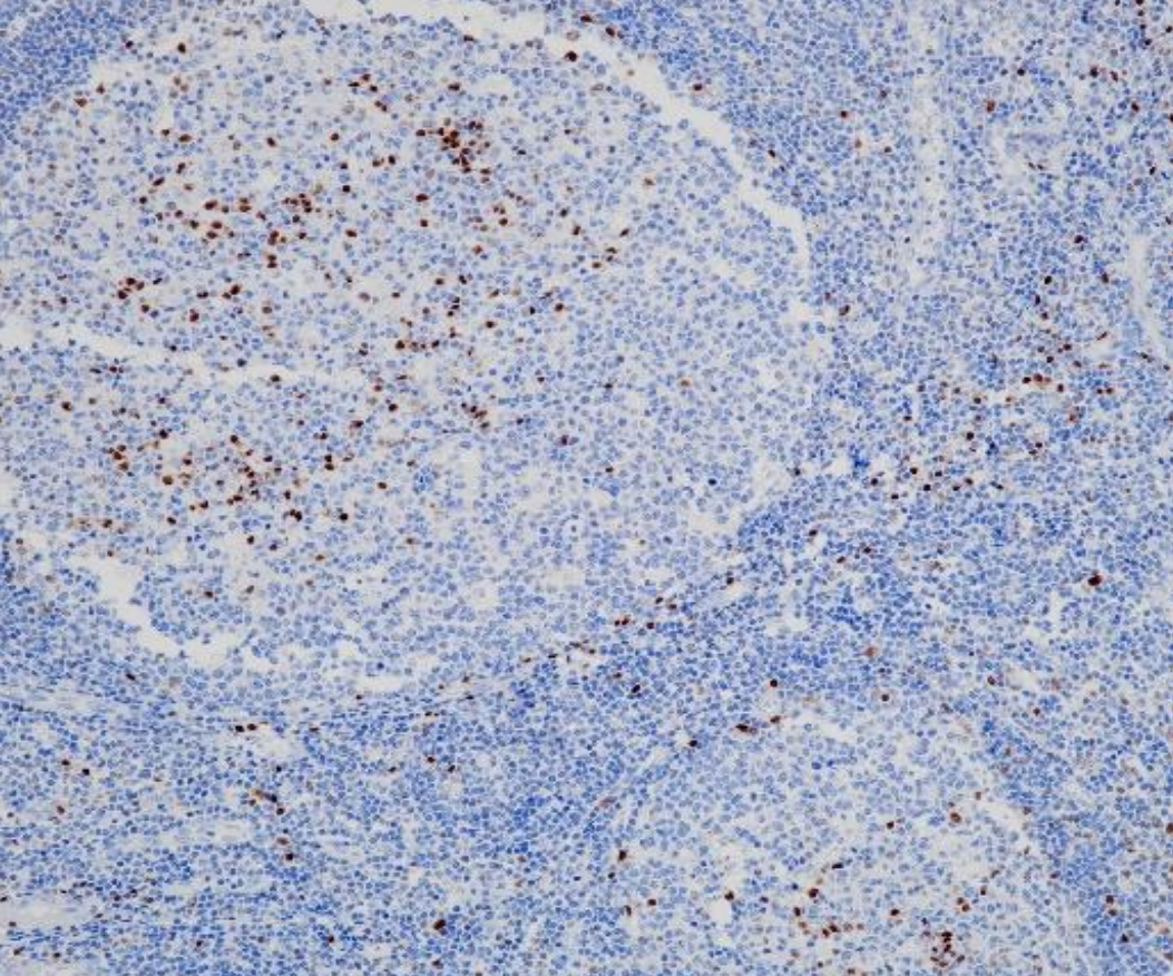 MUM1 Rabbit Monoclonal Antibody(ARB997)