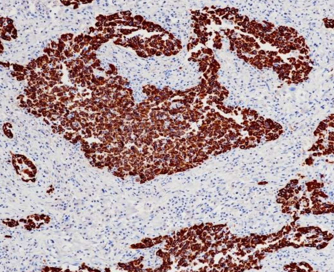 CK5&6  Monoclonal Antibody(ARB591)