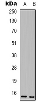 BATF3 Rabbit Polyclonal Antibody