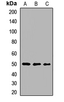 MAGEA4 Rabbit Polyclonal Antibody