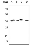 Phospho-RPA2-S4/S8 Rabbit Polyclonal Antibody