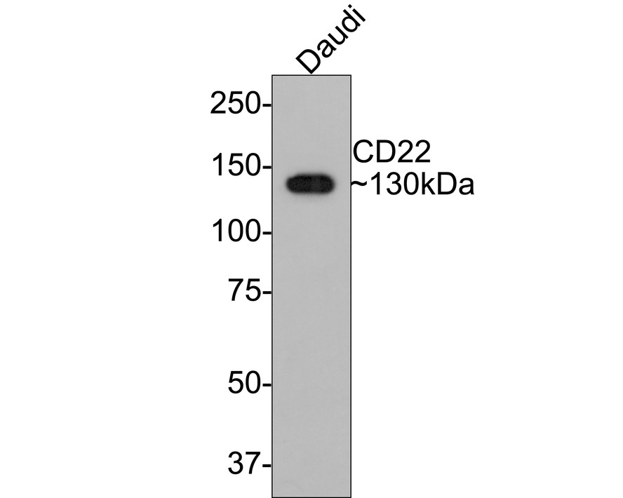 CD22 Rabbit Monoclonal Antibody(ARA824)