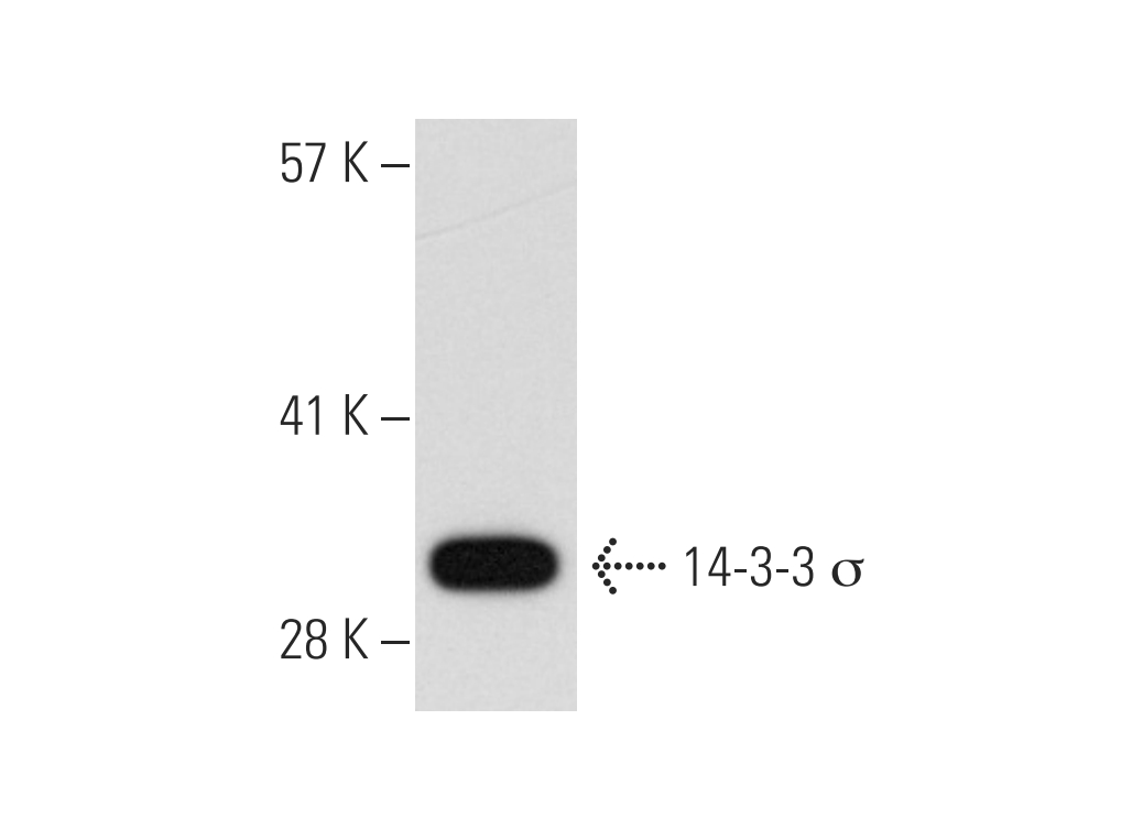 14-3-3 &sigma; Mouse Monoclonal  Antibody (5D7)
