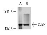 CaSR Mouse Monoclonal Antibody (6D4)