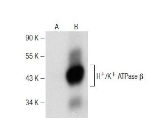 H+/K+ ATPase &beta; Mouse Monoclonal Antibody(ARA827)