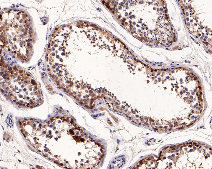CTAG1A/NY-ESO-1 Rabbit Monoclonal Antibody