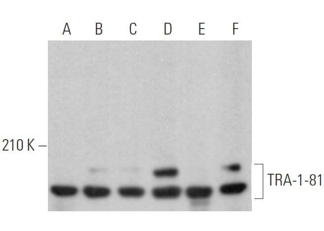 TRA-1-81 Mouse Monoclonal Antibody (TRA-1-80)