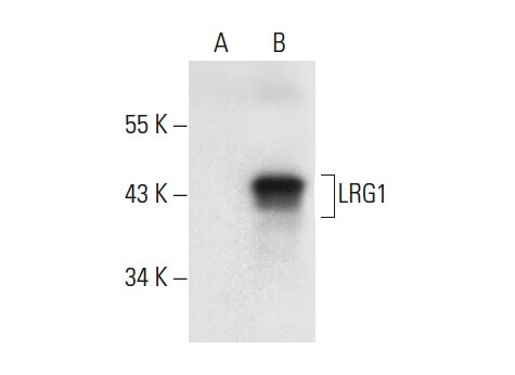 LRG1 Mouse Monoclonal Antibody (C-5)