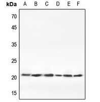 Claudin 1 Rabbit polyclonal antibody