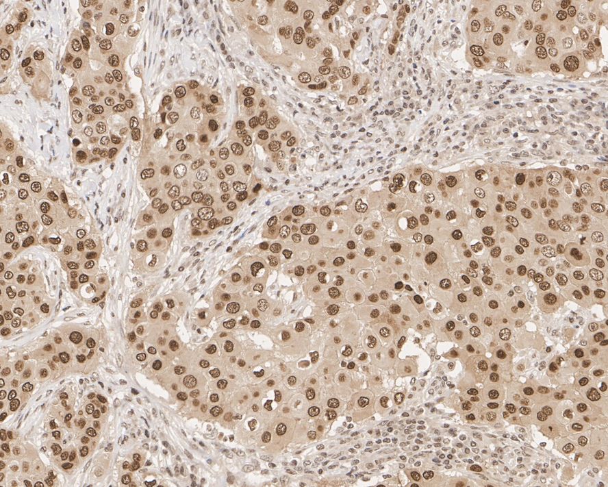 Pan-Lactyl-lysine Rabbit Monoclonal Antibody(ARA826)
