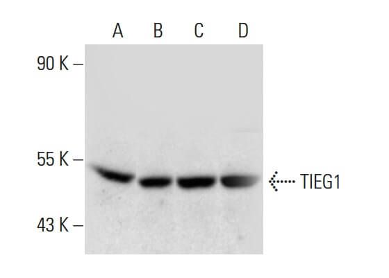 TIEG1 Mouse Monoclonal Antibody (95-D)